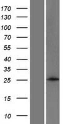 Western Blot: ANKRD46 Overexpression Lysate [NBP2-04733]