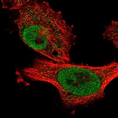 Immunocytochemistry/ Immunofluorescence: ANKRD49 Antibody [NBP1-83902]