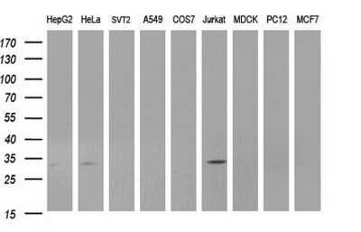 Western Blot: ANKRD49 Antibody (OTI3E4)Azide and BSA Free [NBP2-71971]