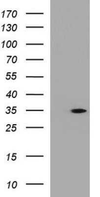 Western Blot: ANKRD49 Antibody (OTI3E4)Azide and BSA Free [NBP2-71971]