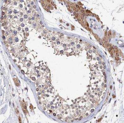 Immunohistochemistry-Paraffin: ANKRD5 Antibody [NBP1-85163]