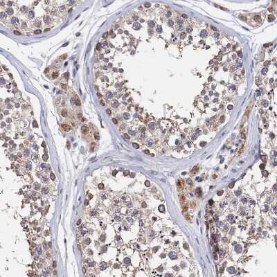 Immunohistochemistry-Paraffin: ANKRD5 Antibody [NBP1-85163]
