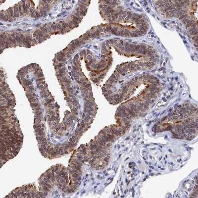 Immunohistochemistry-Paraffin: ANKRD5 Antibody [NBP1-85163]