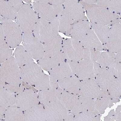 Immunohistochemistry-Paraffin: ANKRD5 Antibody [NBP1-85163]