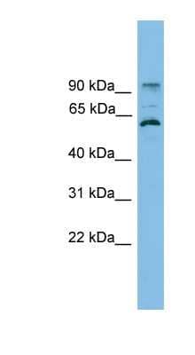 Western Blot: ANKRD5 Antibody [NBP1-56444]