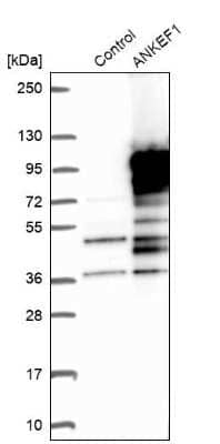 Western Blot: ANKRD5 Antibody [NBP1-85163]