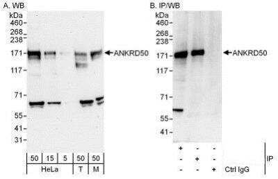 Western Blot: ANKRD50 Antibody [NBP1-50031]