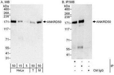 Western Blot: ANKRD50 Antibody [NBP1-50032]