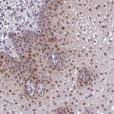 Immunohistochemistry-Paraffin: ANKRD52 Antibody [NBP1-93844]