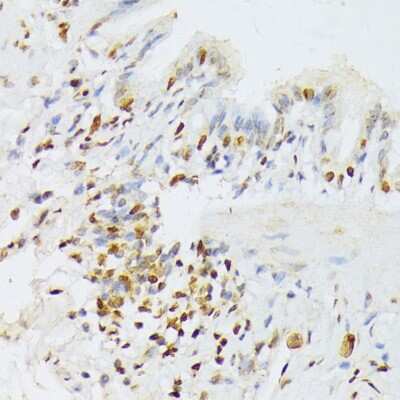 Immunohistochemistry-Paraffin: ANKRD52 Antibody - BSA Free [NBP2-92833]