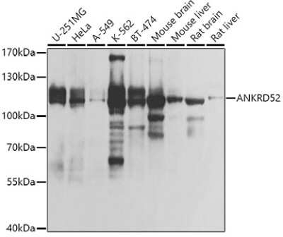 Western Blot: ANKRD52 AntibodyBSA Free [NBP2-92833]