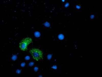 Immunocytochemistry/ Immunofluorescence: ANKRD53 Antibody (OTI1E1) [NBP2-00520]