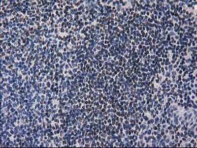 Immunohistochemistry-Paraffin: ANKRD53 Antibody (OTI1E1) [NBP2-00520]