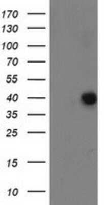 Western Blot: ANKRD53 Antibody (OTI1E1) [NBP2-00520]