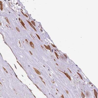 Immunohistochemistry-Paraffin: ANKRD53 Antibody [NBP2-14294]