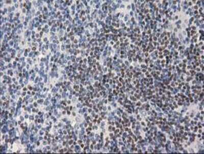 Immunohistochemistry: ANKRD53 Antibody (OTI1E1) - Azide and BSA Free [NBP2-72217]
