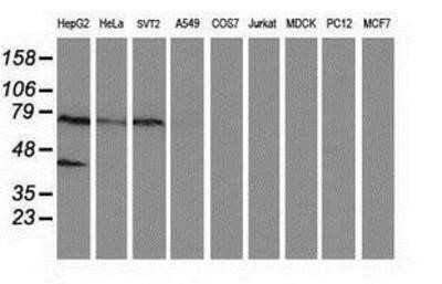 Western Blot: ANKRD53 Antibody (OTI1E1)Azide and BSA Free [NBP2-72217]
