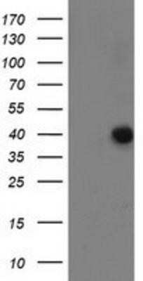 Western Blot: ANKRD53 Antibody (OTI1E1)Azide and BSA Free [NBP2-72217]