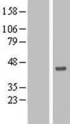 Western Blot: ANKRD53 Overexpression Lysate [NBL1-07545]