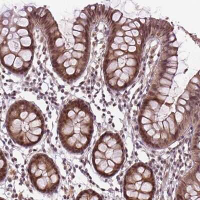 Immunohistochemistry: ANKRD54 Antibody [NBP2-49652]