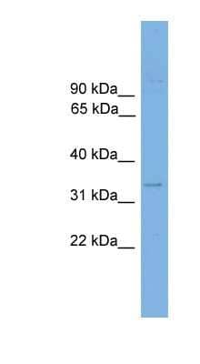 Western Blot: ANKRD54 Antibody [NBP1-57052]