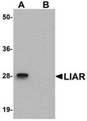 Western Blot: ANKRD54 AntibodyBSA Free [NBP1-77051]