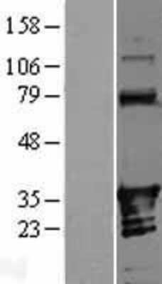 Western Blot: ANKRD54 Overexpression Lysate [NBL1-07546]