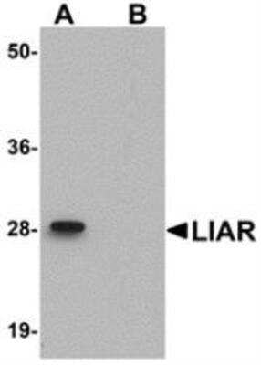 Western Blot: ANKRD54 Antibody Blocking Peptide [NBP1-77051PEP]