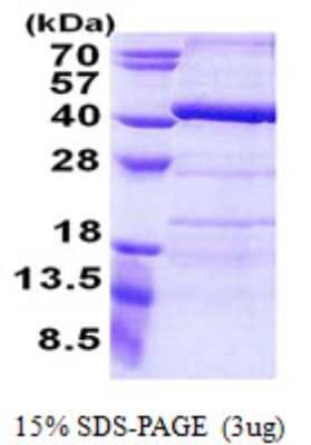 SDS-PAGE: Recombinant Human ANKRD54 His Protein [NBP2-22688]