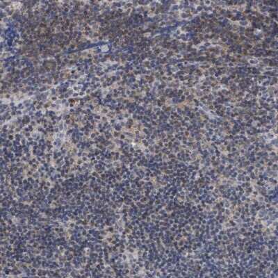 Immunohistochemistry-Paraffin: ANKRD55 Antibody [NBP2-14719]