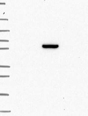 Western Blot: ANKRD55 Antibody [NBP3-17467]