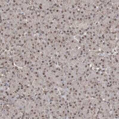 Immunohistochemistry: ANKRD56 Antibody [NBP2-48666]