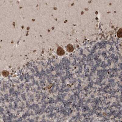 Immunohistochemistry-Paraffin: ANKRD56 Antibody [NBP1-90905]