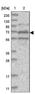 Western Blot: ANKRD56 Antibody [NBP1-90905]