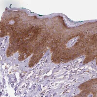 Immunohistochemistry-Paraffin: ANKRD57 Antibody [NBP2-49215]