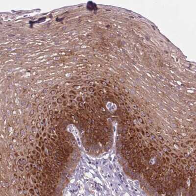 Immunohistochemistry-Paraffin: ANKRD57 Antibody [NBP2-49215]