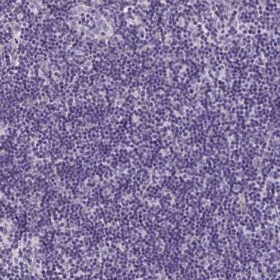 Immunohistochemistry-Paraffin: ANKRD57 Antibody [NBP2-49215]