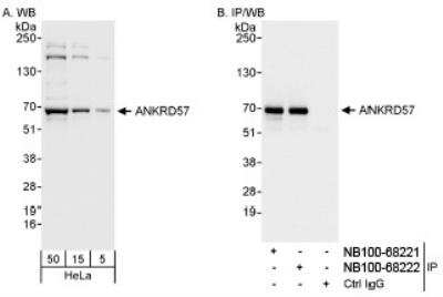 Western Blot: ANKRD57 Antibody [NB100-68221]