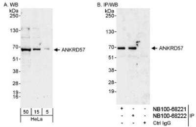 Western Blot: ANKRD57 Antibody [NB100-68222]