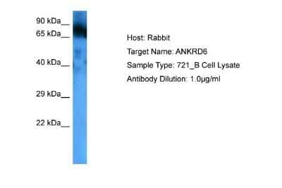 Western Blot: ANKRD6 Antibody [NBP2-87008]