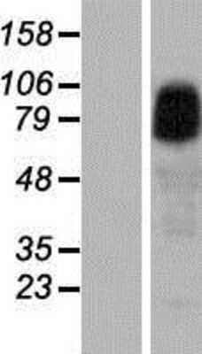 Western Blot: ANKRD6 Overexpression Lysate [NBP2-07241]