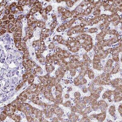 Immunohistochemistry-Paraffin: ANKRD60 Antibody [NBP2-32554]