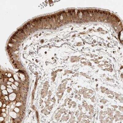 Immunohistochemistry: ANKRD61 Antibody [NBP1-91030]