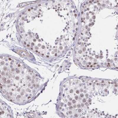 Immunohistochemistry-Paraffin: ANKRD62 Antibody [NBP2-32495]