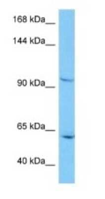 Western Blot: ANKRD62 Antibody [NBP3-10977]