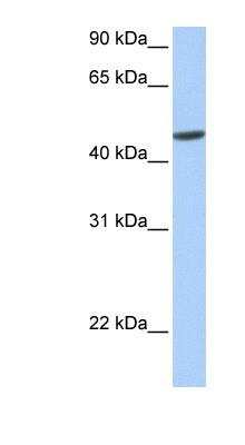 Western Blot: ANKRD65 Antibody [NBP1-91320]