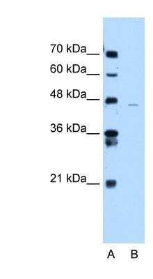 Western Blot: ANKRD65 Antibody [NBP1-91321]