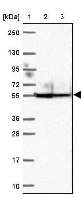 Western Blot: ANKRD65 Antibody [NBP2-39062]