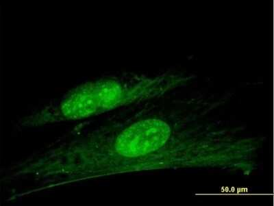 Immunocytochemistry/ Immunofluorescence: ANKRD7 Antibody [H00056311-B01P]