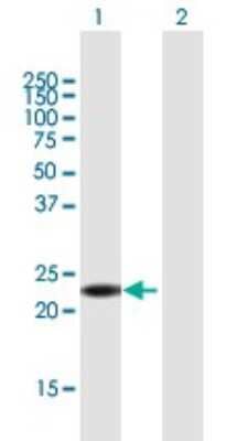 Western Blot: ANKRD7 Antibody [H00056311-B01P]